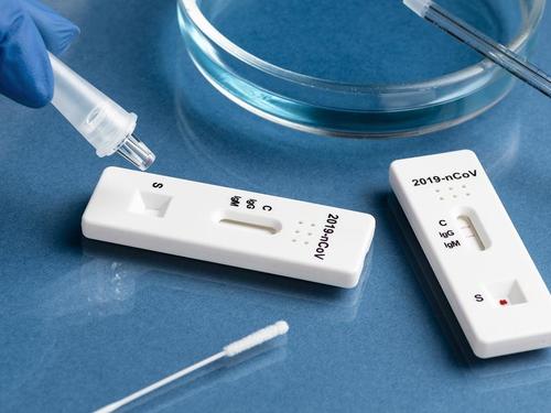 Las farmacias valencianas registran un total de 5.795 test de antígenos en cinco días