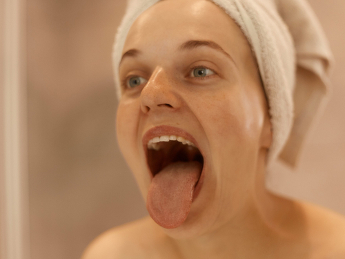 ¿Es la escarlatina contagiosa? ¿Es la escarlatina contagiosa?